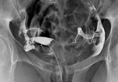 Hysterosalpingographie Paris 18 17 19 9 91 92 93 94 95 Rdv Doctolib