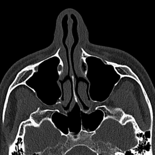 scanner sinus paris