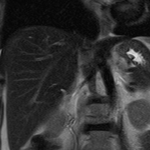 IRM hépatique Paris