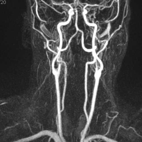 Angio IRM TSA IMBM Radiologie Paris