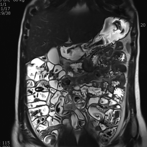 Entero IRM IMBM Radiologie Paris