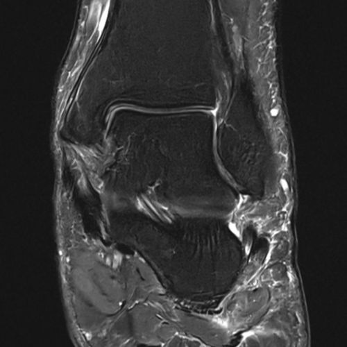 IRM cheville paris IMBM Radiologie