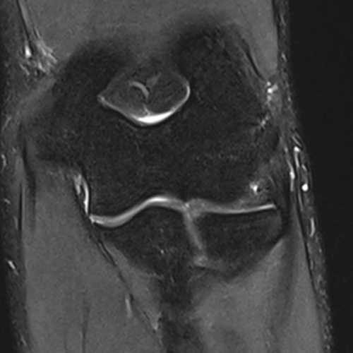 IRM coude paris IMBM Radiologie