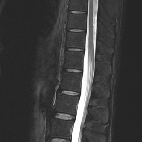 IRM dorsal et dorso-lombaire paris IMBM Radiologie