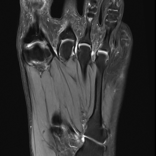 IRM pied paris IMBM Radiologie