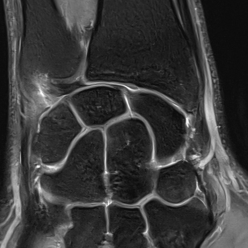 IRM poignet paris IMBM Radiologie