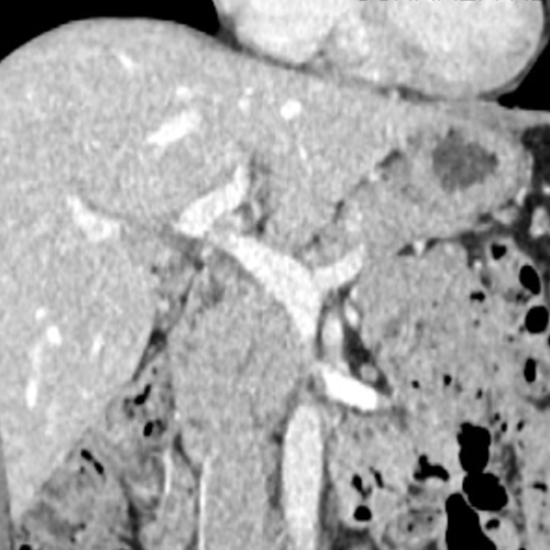 Scanner hépatique IMBM Radiologie Paris