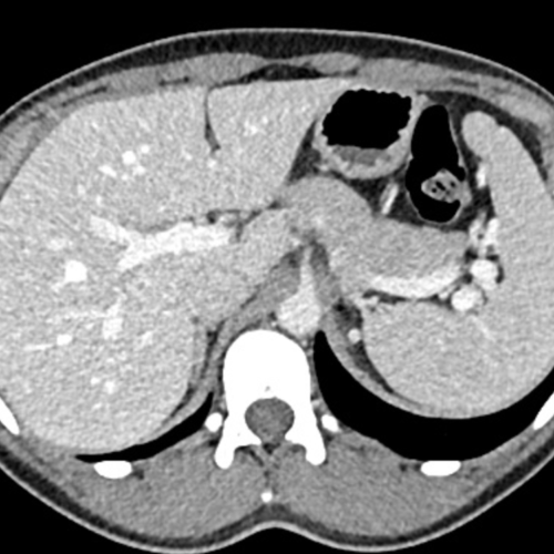 Scanner pancréas IMBM Radiologie Paris