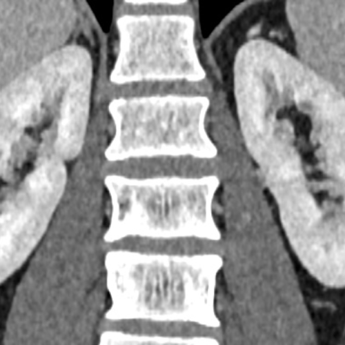 Scanner rénal IMBM Radiologie Paris
