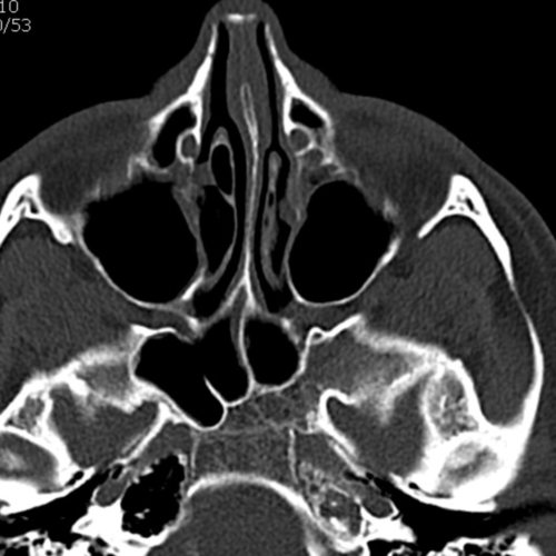 Scanner sinus IMBM Radiologie Paris