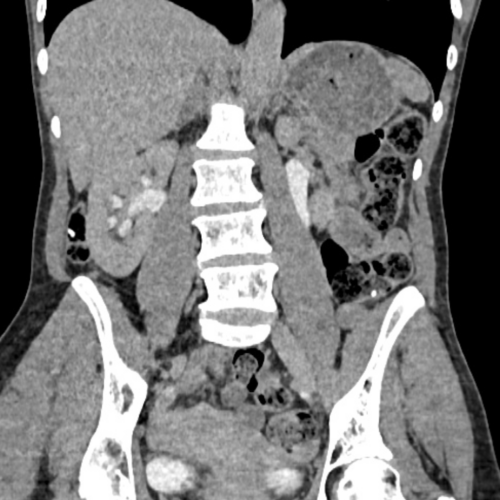 Uroscanner Paris IMBM Radiologie Paris