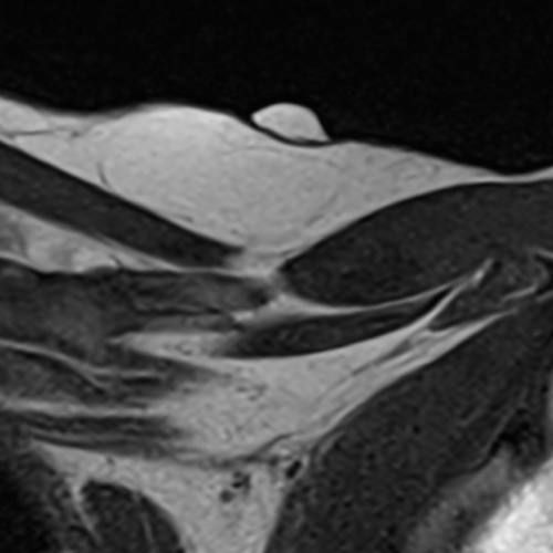IRM parties molles Paris IMBM Radiologie Paris